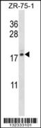 Transition Protein 2 antibody, 56-661, ProSci, Western Blot image 