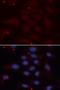 Solute carrier family 22 member 18 antibody, orb325094, Biorbyt, Immunofluorescence image 