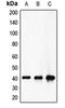 Coagulation Factor XII antibody, orb213916, Biorbyt, Western Blot image 