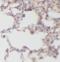 VAC14 Component Of PIKFYVE Complex antibody, FNab09356, FineTest, Immunohistochemistry paraffin image 
