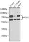 Pregnancy-specific beta-1-glycoprotein 1 antibody, GTX55761, GeneTex, Western Blot image 