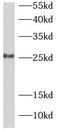 Joining Chain Of Multimeric IgA And IgM antibody, FNab04187, FineTest, Western Blot image 