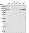 Vacuolar protein sorting-associated protein 11 homolog antibody, HPA039020, Atlas Antibodies, Western Blot image 