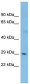 Dual specificity protein kinase CLK2 antibody, TA340040, Origene, Western Blot image 