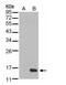 Dual Specificity Phosphatase 23 antibody, PA5-28773, Invitrogen Antibodies, Western Blot image 