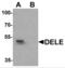 DAP3 Binding Cell Death Enhancer 1 antibody, NBP2-81912, Novus Biologicals, Western Blot image 