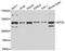 Eukaryotic Translation Initiation Factor 3 Subunit C antibody, abx005318, Abbexa, Western Blot image 