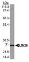 Lin-28 Homolog A antibody, TA336788, Origene, Western Blot image 