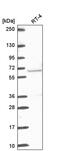 ETS Variant 5 antibody, PA5-66555, Invitrogen Antibodies, Western Blot image 