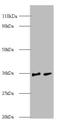 Small Nuclear Ribonucleoprotein Polypeptide G antibody, A53897-100, Epigentek, Western Blot image 