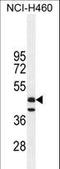 Fibroleukin antibody, LS-C166147, Lifespan Biosciences, Western Blot image 