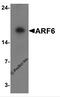 ADP Ribosylation Factor 6 antibody, 7699, ProSci Inc, Western Blot image 