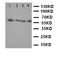 Lecithin-Cholesterol Acyltransferase antibody, orb97093, Biorbyt, Western Blot image 