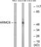 Armadillo Repeat Containing 6 antibody, GTX87183, GeneTex, Western Blot image 