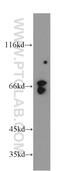5-Aminoimidazole-4-Carboxamide Ribonucleotide Formyltransferase/IMP Cyclohydrolase antibody, 10726-1-AP, Proteintech Group, Western Blot image 