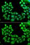 TIMP Metallopeptidase Inhibitor 4 antibody, GTX16463, GeneTex, Immunofluorescence image 