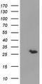 Glutathione S-Transferase Theta 2 (Gene/Pseudogene) antibody, TA501881, Origene, Western Blot image 