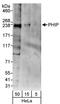 PHIP antibody, NBP1-19095, Novus Biologicals, Western Blot image 