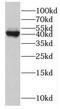 MAGE Family Member A1 antibody, FNab04934, FineTest, Western Blot image 