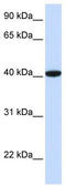 General Transcription Factor IIB antibody, TA330171, Origene, Western Blot image 