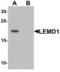 LEM Domain Containing 1 antibody, LS-C144453, Lifespan Biosciences, Western Blot image 