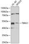 Transforming Growth Factor Beta Regulator 1 antibody, 22-751, ProSci, Western Blot image 