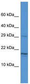 Hematological and neurological expressed 1 protein antibody, TA335564, Origene, Western Blot image 