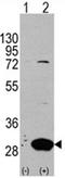 Latexin antibody, AP11459PU-N, Origene, Western Blot image 