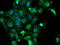 N-Ribosyldihydronicotinamide:Quinone Reductase 2 antibody, TA504784, Origene, Immunofluorescence image 