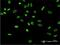 Heterogeneous Nuclear Ribonucleoprotein A2/B1 antibody, H00003181-M02, Novus Biologicals, Immunocytochemistry image 