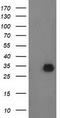Phenylethanolamine N-Methyltransferase antibody, TA502825, Origene, Western Blot image 
