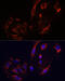 Connective tissue growth factor antibody, 13-902, ProSci, Immunofluorescence image 