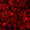 Histone-lysine N-methyltransferase SETD2 antibody, LS-C668741, Lifespan Biosciences, Immunofluorescence image 