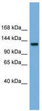 Ras-GRF1 antibody, TA342189, Origene, Western Blot image 