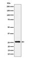 Indolethylamine N-Methyltransferase antibody, M09175-1, Boster Biological Technology, Western Blot image 