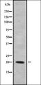 Carcinoembryonic Antigen Related Cell Adhesion Molecule 20 antibody, orb338141, Biorbyt, Western Blot image 