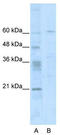 Zinc Finger With KRAB And SCAN Domains 8 antibody, TA332039, Origene, Western Blot image 