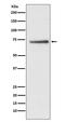 Cell division cycle protein 16 homolog antibody, M04573, Boster Biological Technology, Western Blot image 