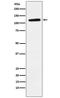 EPH Receptor B1 antibody, M02811-1, Boster Biological Technology, Western Blot image 