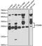 Proteasome Subunit Beta 8 antibody, A7340, ABclonal Technology, Western Blot image 