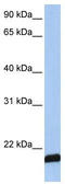 ADP Ribosylation Factor 6 antibody, TA335020, Origene, Western Blot image 