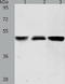 Acyl-CoA Thioesterase 9 antibody, TA323402, Origene, Western Blot image 