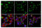 Microtubule Associated Protein 1 Light Chain 3 Beta antibody, 43566S, Cell Signaling Technology, Immunofluorescence image 