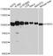 Poly(ADP-Ribose) Glycohydrolase antibody, abx126321, Abbexa, Western Blot image 