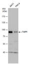 Mtp1 antibody, GTX129963, GeneTex, Western Blot image 