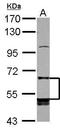Leukocyte Immunoglobulin Like Receptor B5 antibody, GTX104193, GeneTex, Western Blot image 