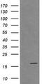 Cancer/Testis Antigen 1B antibody, TA505959, Origene, Western Blot image 