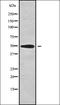Aquaporin-9 antibody, orb338021, Biorbyt, Western Blot image 
