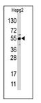 Jumonji Domain Containing 4 antibody, AP11044PU-N, Origene, Western Blot image 