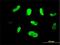 Serine/threonine-protein kinase MAK antibody, H00004117-M01, Novus Biologicals, Immunocytochemistry image 